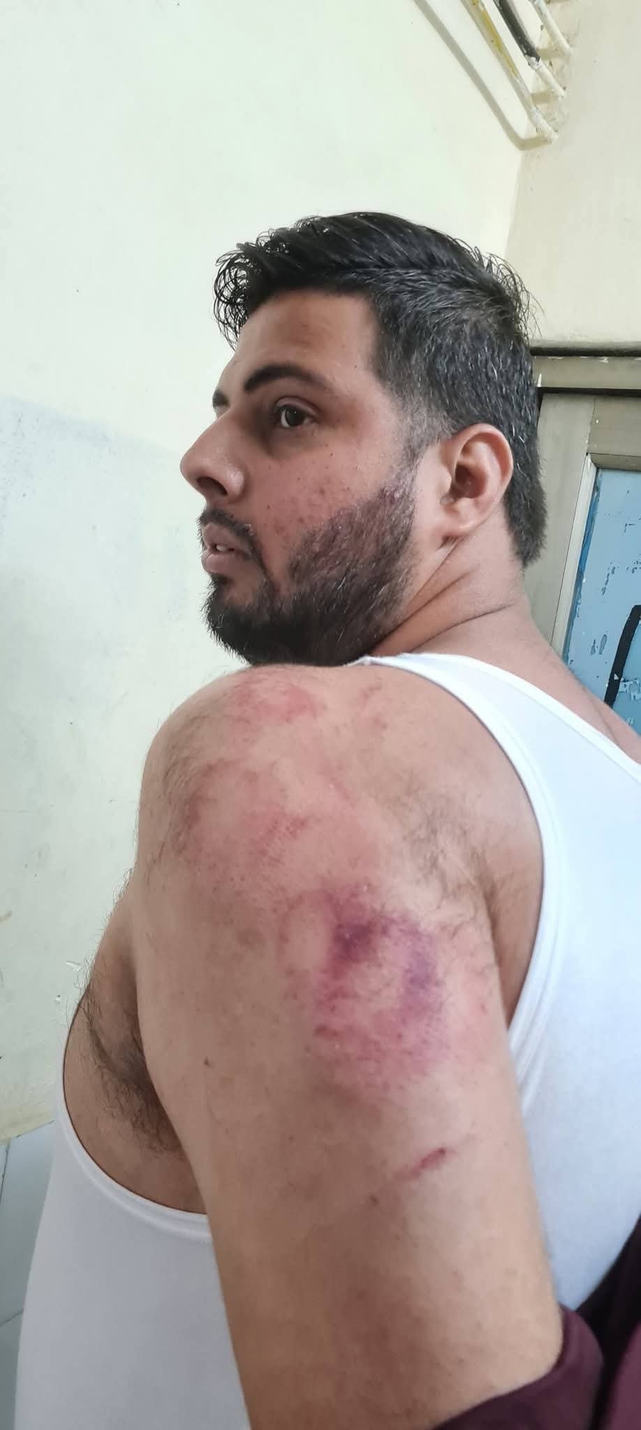 कांग्रेस पार्षद व आप नेता में चले लात-घूंसे